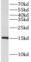 AIF1 antibody|AIF1抗体 FNab09944