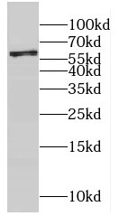 CYP4F12 antibody|CYP4F12抗体