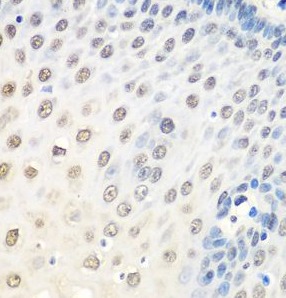 HNRNPA0 antibody|HNRNPA0抗体