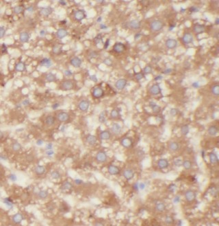 ASGR1 antibody|ASGR1抗体
