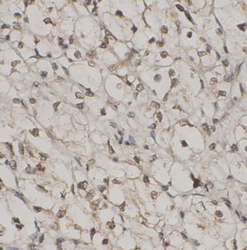 IGFBP2 antibody|IGFBP2抗体 FNab1