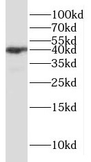 HMBS antibody|HMBS抗体