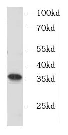 CNTD1 antibody|CNTD1抗体