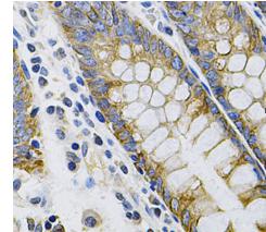 KRT20 antibody|KRT20抗体 FNab022