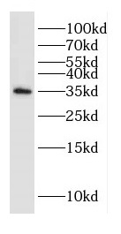 DAZL antibody|DAZL抗体