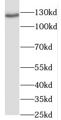 RANBP6 antibody|RANBP6抗体