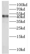 MRPL38 antibody|MRPL38抗体