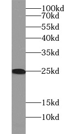 FAM3C antibody|FAM3C抗体 FNab029