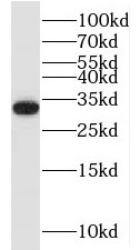 OLIG2 antibody|OLIG2抗体 FNab059