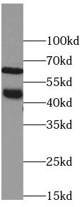 SSTR1 antibody|SSTR1抗体