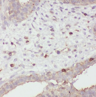 SCGB2A2 antibody|SCGB2A2抗体 FNa