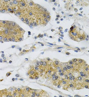 PTPRA antibody|PTPRA抗体