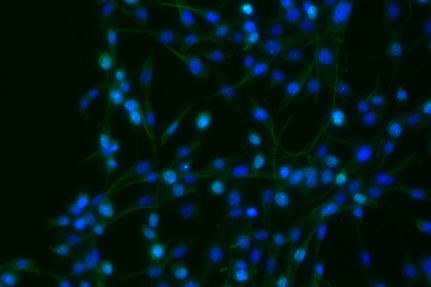 WBP11 antibody|WBP11抗体