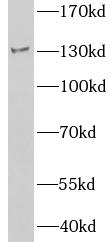 HDAC4 antibody|HDAC4抗体 FNab099