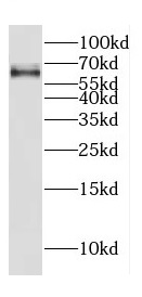 CREB3L2 antibody|CREB3L2抗体