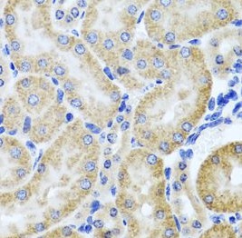 HDAC6 antibody|HDAC6抗体 FNab038