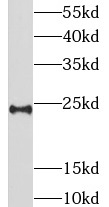 LIN7B antibody|LIN7B抗体