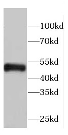 KYAT1 antibody|KYAT1抗体