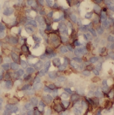 KRT7 antibody|KRT7抗体 FNab02218