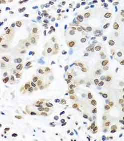 IGF2BP1 antibody|IGF2BP1抗体