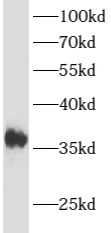 ATOH1 antibody|ATOH1抗体