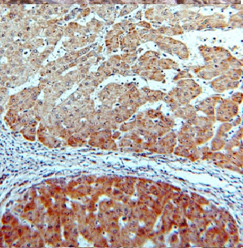 CYP26B1 antibody|CYP26B1抗体