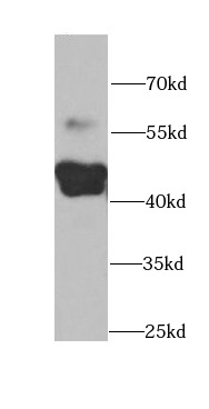 CYP2F1 antibody|CYP2F1抗体