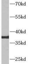 AQP9 antibody|AQP9抗体