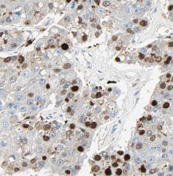 SUGT1 antibody|SUGT1抗体