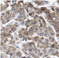 SLC2A9 antibody|SLC2A9抗体