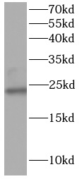NPC2 antibody|NPC2抗体 FNab10049