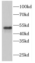 FBXW4 antibody|FBXW4抗体