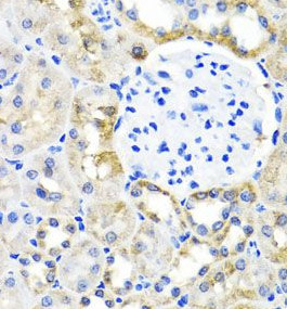 SHMT1 antibody|SHMT1抗体