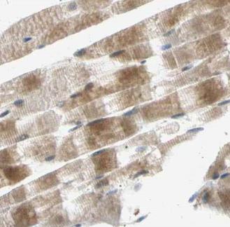 ACACA antibody|ACACA抗体