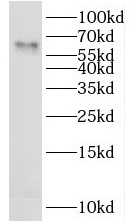 LAD1 antibody|LAD1抗体