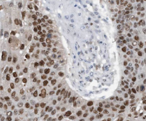 LGI3 antibody|LGI3抗体