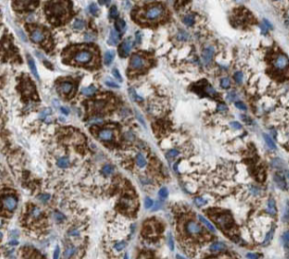 ROBO3-Specific antibody|ROBO3抗