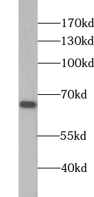 ZNF512 antibody|ZNF512抗体