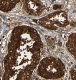 STAMBP antibody|STAMBP抗体