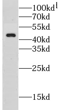 CLEC4M antibody|CLEC4M抗体