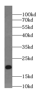 ARPP19 antibody|ARPP19抗体