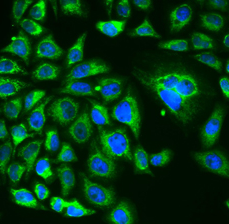 RCVRN antibody|RCVRN抗体