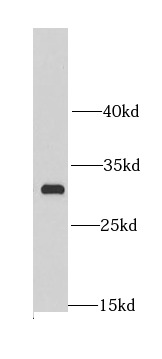 MRPL28 antibody|MRPL28抗体