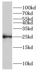 GCSAM antibody|GCSAM抗体