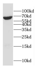 CD33 antibody|CD33抗体