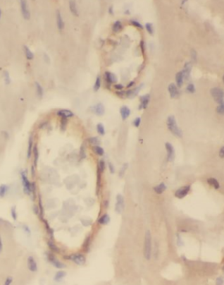 ANXA8 antibody|ANXA8抗体