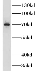 CLCNKA antibody|CLCNKA抗体
