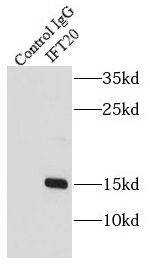 HEBP2 antibody|HEBP2抗体