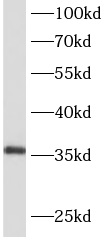 AIDA antibody|AIDA抗体