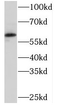 PKLR antibody|PKLR抗体 FNab06490